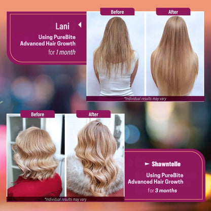 PureBite™ Hair Growth Vitamins for Women